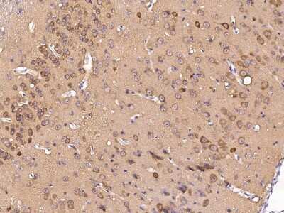 Immunohistochemistry: S100A5 Antibody (001) [NBP2-90581]