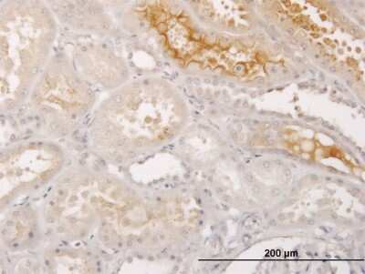 Immunohistochemistry-Paraffin: S100A5 Antibody (5E1) [H00006276-M03]