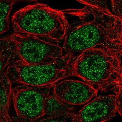 Immunocytochemistry/ Immunofluorescence: S100A5 Antibody [NBP2-56319]