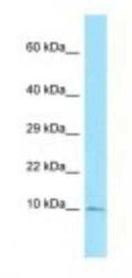 Western Blot: S100A5 Antibody [NBP1-98577]