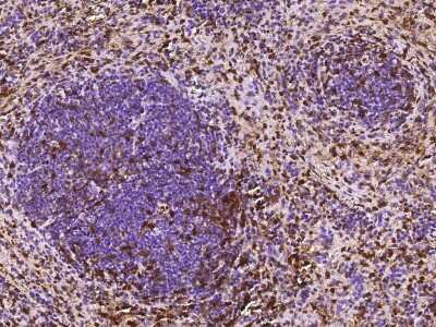 Immunohistochemistry-Paraffin: S100A6 Antibody (016) [NBP2-90488]