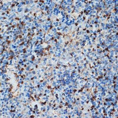 Immunohistochemistry-Paraffin: S100A6 Antibody (0J1Q5) [NBP3-16191]