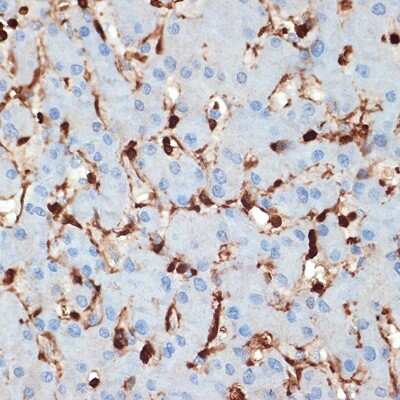 Immunohistochemistry-Paraffin: S100A6 Antibody (0J1Q5) [NBP3-16191]