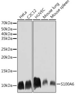 Western Blot: S100A6 Antibody (0J1Q5) [NBP3-16191]