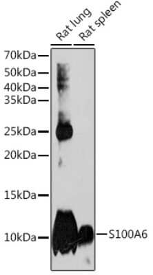 Western Blot: S100A6 Antibody (0J1Q5) [NBP3-16191]