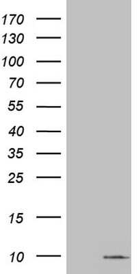 Western Blot: S100A6 Antibody (OTI5A10) [NBP2-45661]