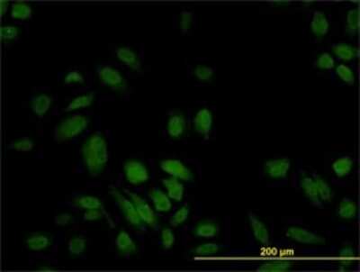 Immunocytochemistry/ Immunofluorescence: S100A6 Antibody (6B5) [H00006277-M10]
