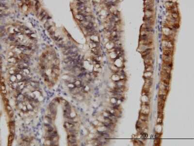 Immunohistochemistry-Paraffin: S100A6 Antibody (6B5) [H00006277-M10]