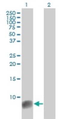 Western Blot: S100A6 Antibody (6B5) [H00006277-M10]