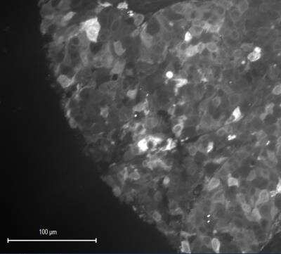 Immunohistochemistry-Paraffin: S100A6 Antibody (7D11) - BSA Free [NB100-1765]