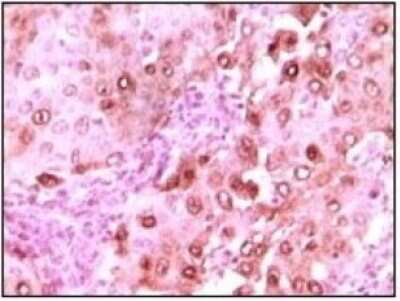 Immunohistochemistry-Paraffin: S100A6 Antibody (7D11) - BSA Free [NB100-1765]