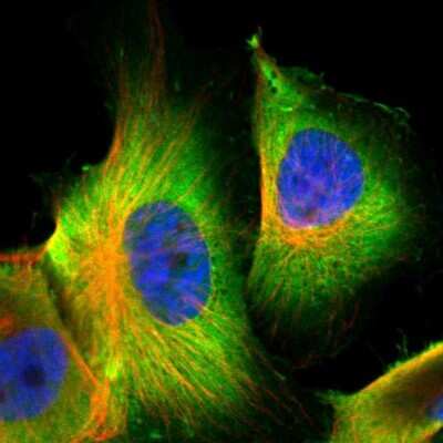Immunocytochemistry/ Immunofluorescence: S100A6 Antibody [NBP1-89388]