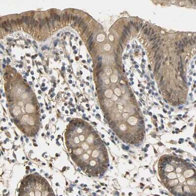 Immunohistochemistry-Paraffin: S100A6 Antibody [NBP1-89388]