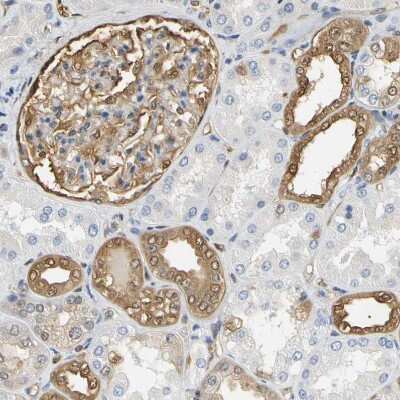 Immunohistochemistry-Paraffin: S100A6 Antibody [NBP1-89388]