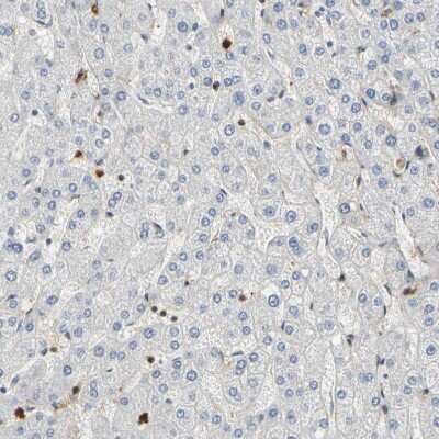 Immunohistochemistry-Paraffin: S100A6 Antibody [NBP1-89388]
