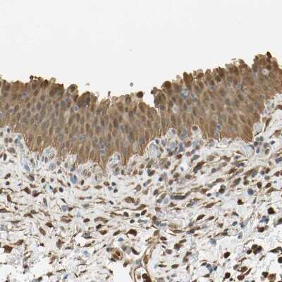 Immunohistochemistry-Paraffin: S100A6 Antibody [NBP1-89388]