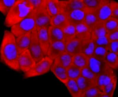 Immunocytochemistry/ Immunofluorescence: S100A6 Antibody (JF0976) [NBP2-67123]