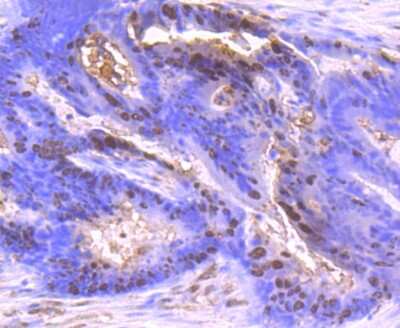 Immunohistochemistry-Paraffin: S100A6 Antibody (JF0976) [NBP2-67123]