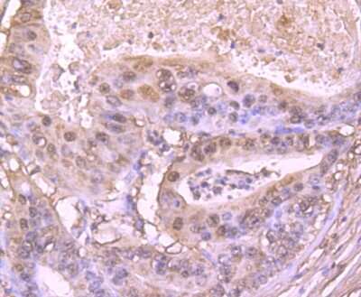 Immunohistochemistry-Paraffin: S100A6 Antibody (JF0976) [NBP2-67123]