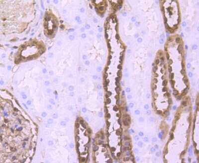 Immunohistochemistry-Paraffin: S100A6 Antibody (JF0976) [NBP2-67123]