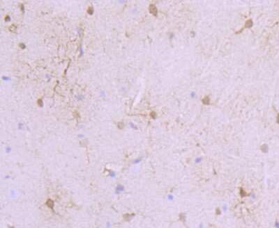 Immunohistochemistry-Paraffin: S100A6 Antibody (JF0976) [NBP2-67123]