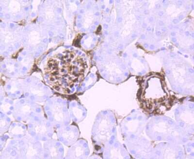 Immunohistochemistry-Paraffin: S100A6 Antibody (JF0976) [NBP2-67123]