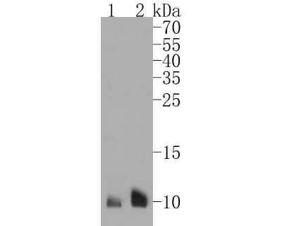 Western Blot: S100A6 Antibody (JF0976) [NBP2-67123]