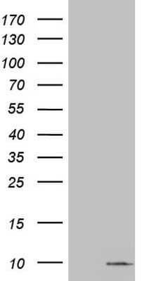 Western Blot: S100A6 Antibody (OTI5A10)Azide and BSA Free [NBP2-73969]