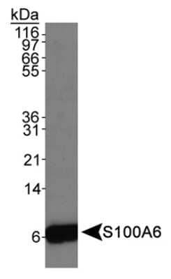 Western Blot: S100A6 Antibody [NB110-93274]