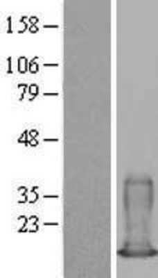 Western Blot: S100A6 Overexpression Lysate [NBL1-15658]