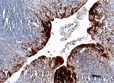 Immunohistochemistry-Paraffin: S100A7/Psoriasin Antibody (129) [NBP2-89814]