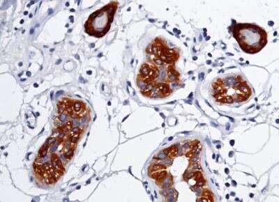 Immunohistochemistry-Paraffin: S100A7/Psoriasin Antibody (129) [NBP2-89814]