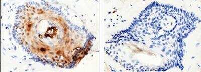 Immunohistochemistry-Paraffin: S100A7/Psoriasin Antibody (129) [NBP2-89814]