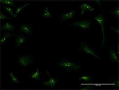 Immunocytochemistry/ Immunofluorescence: S100A7/Psoriasin Antibody (1C5-C6) [H00006278-M01]