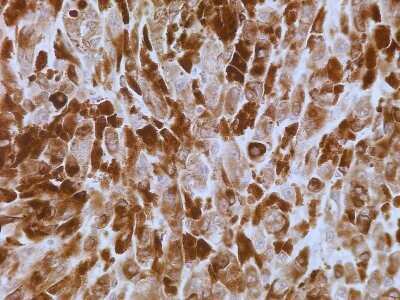 Immunohistochemistry-Paraffin: S100A7/Psoriasin Antibody (47C1068) - Azide Free [NBP2-24911]