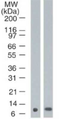 Western Blot: S100A7/Psoriasin Antibody (47C1068)Azide Free [NBP2-24911]