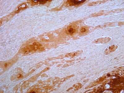 Immunohistochemistry-Paraffin: S100A7/Psoriasin Antibody (47C1068) - BSA Free [NB100-56559]