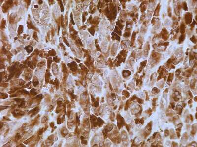 Immunohistochemistry-Paraffin: S100A7/Psoriasin Antibody (47C1068) - BSA Free [NB100-56559]