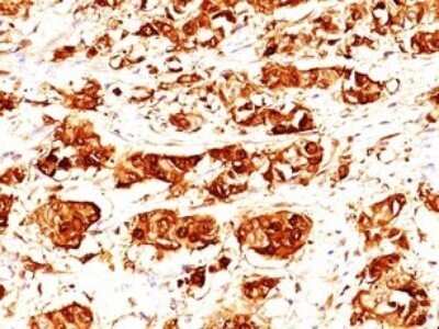 Immunohistochemistry-Paraffin: S100A7/Psoriasin Antibody (47C1068) - BSA Free [NB100-56559]