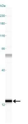 Simple Western: S100A7/Psoriasin Antibody (47C1068)BSA Free [NB100-56559]