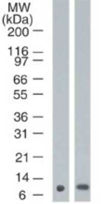 Western Blot: S100A7/Psoriasin Antibody (47C1068)BSA Free [NB100-56559]