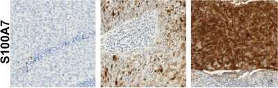 Immunohistochemistry: S100A7/Psoriasin Antibody [NBP1-87205]