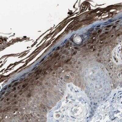 Immunohistochemistry-Paraffin: S100A7/Psoriasin Antibody [NBP1-87205]