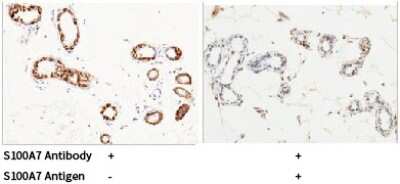 Immunohistochemistry-Paraffin: S100A7/Psoriasin Antibody [NBP2-99720]