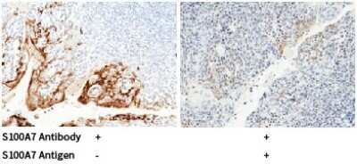 Immunohistochemistry-Paraffin: S100A7/Psoriasin Antibody [NBP2-99720]