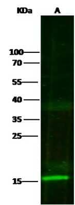 Western Blot: S100A7/Psoriasin Antibody [NBP2-99720]