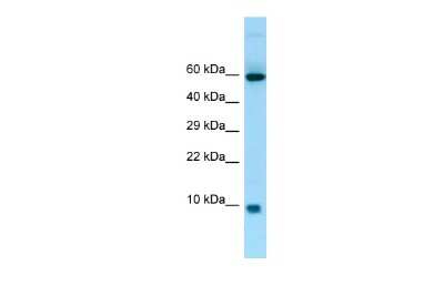 Western Blot: S100A7A Antibody [NBP3-09472]