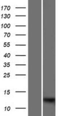 Western Blot: S100A7L2 Overexpression Lysate [NBP2-08342]