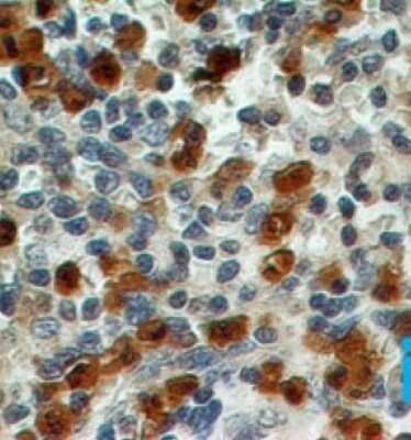Immunohistochemistry-Paraffin: S100A8 Antibody (48M7C7) - Azide Free [NBP2-25269]