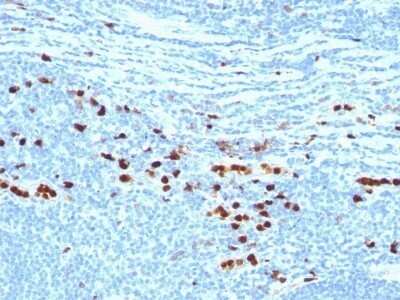 Immunohistochemistry-Paraffin: S100A9 Antibody (MAC387) - Azide and BSA Free [NBP2-47667]